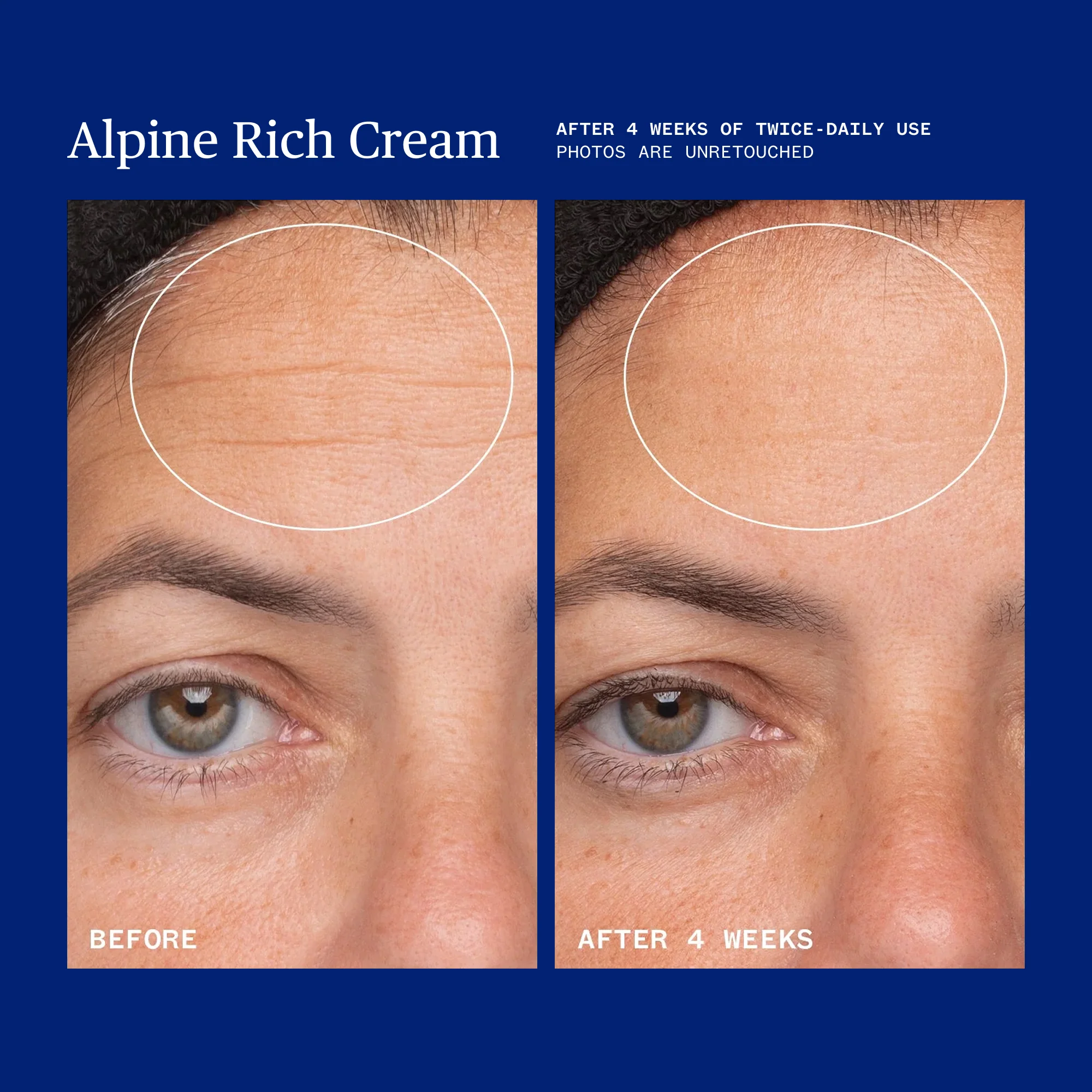 Alpine Rich Cream - Image 8