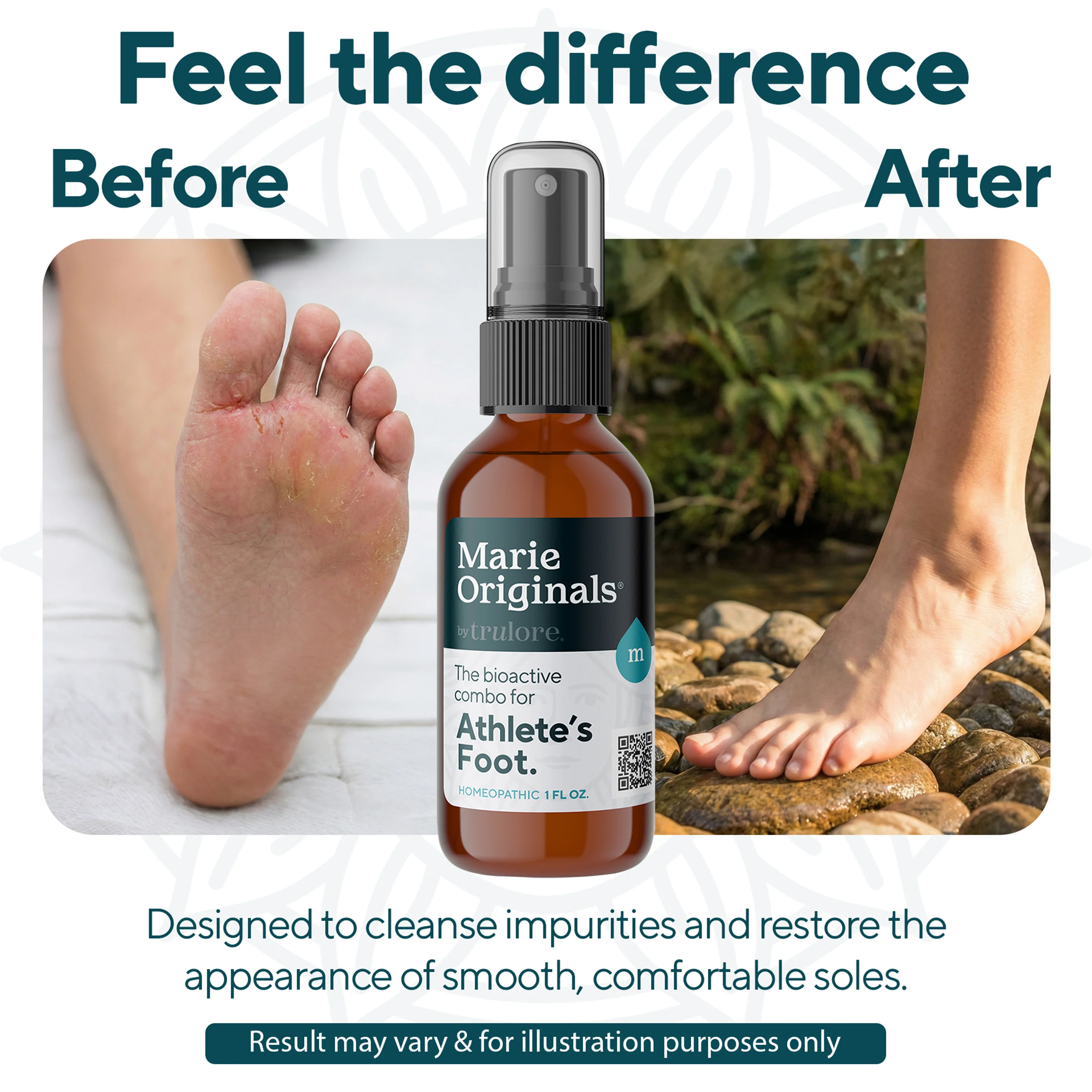 Athlete's Foot Relief Spray - Image 2