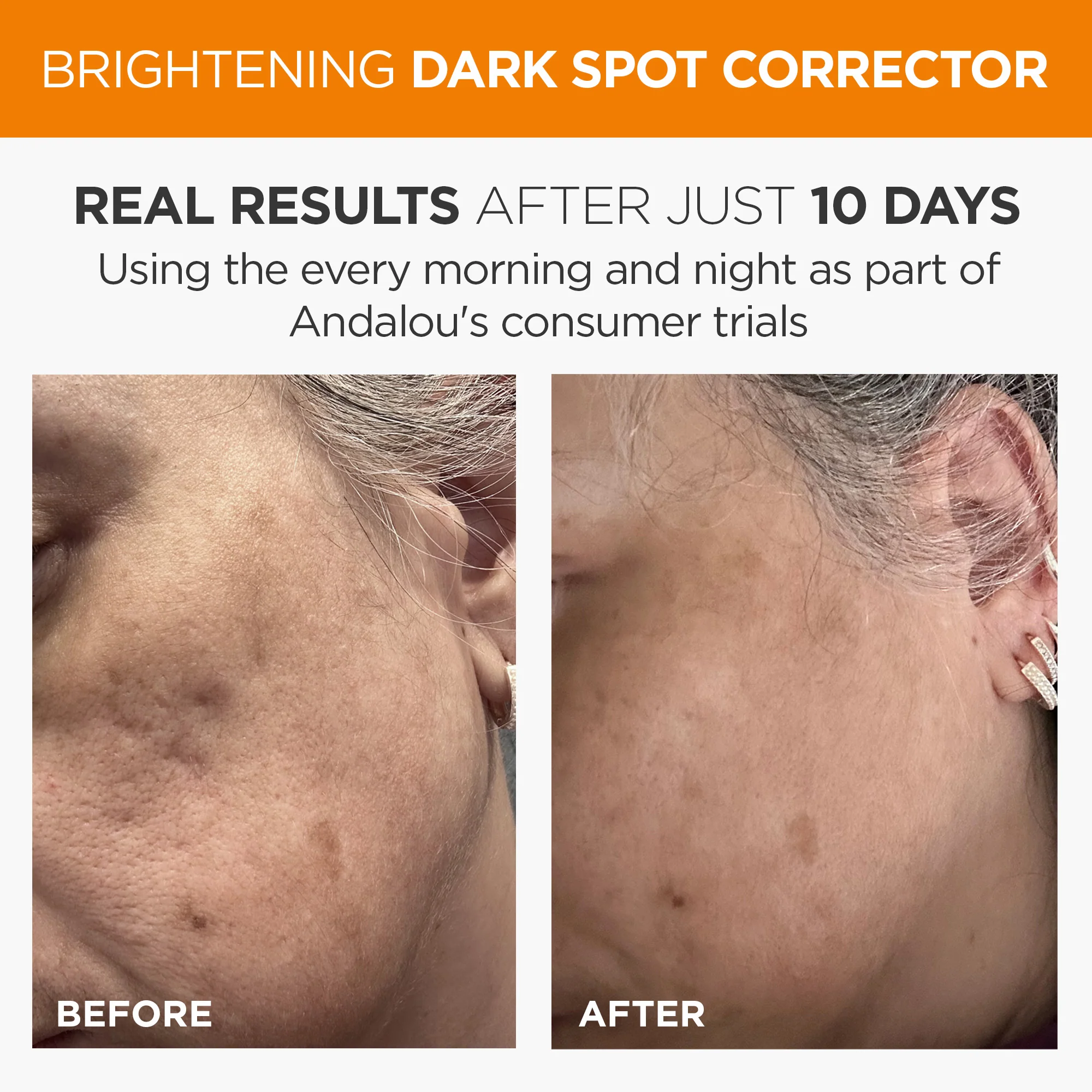 Brightening Dark Spot Corrector - Image 3