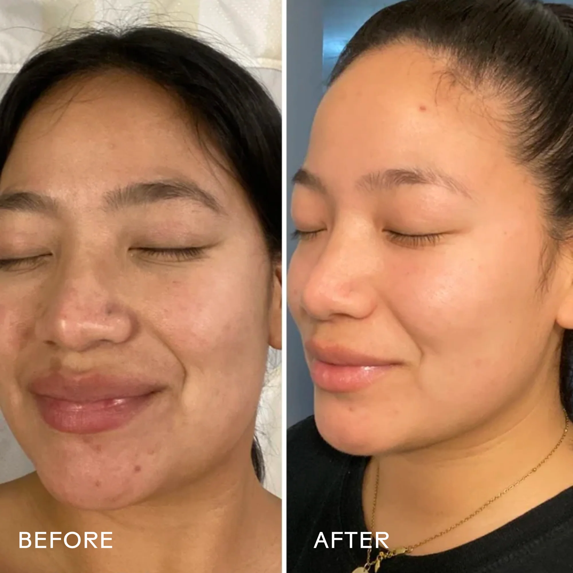 Dream Bio-Retinol + Shorea Butter Rejuvenating Cream - Image 2