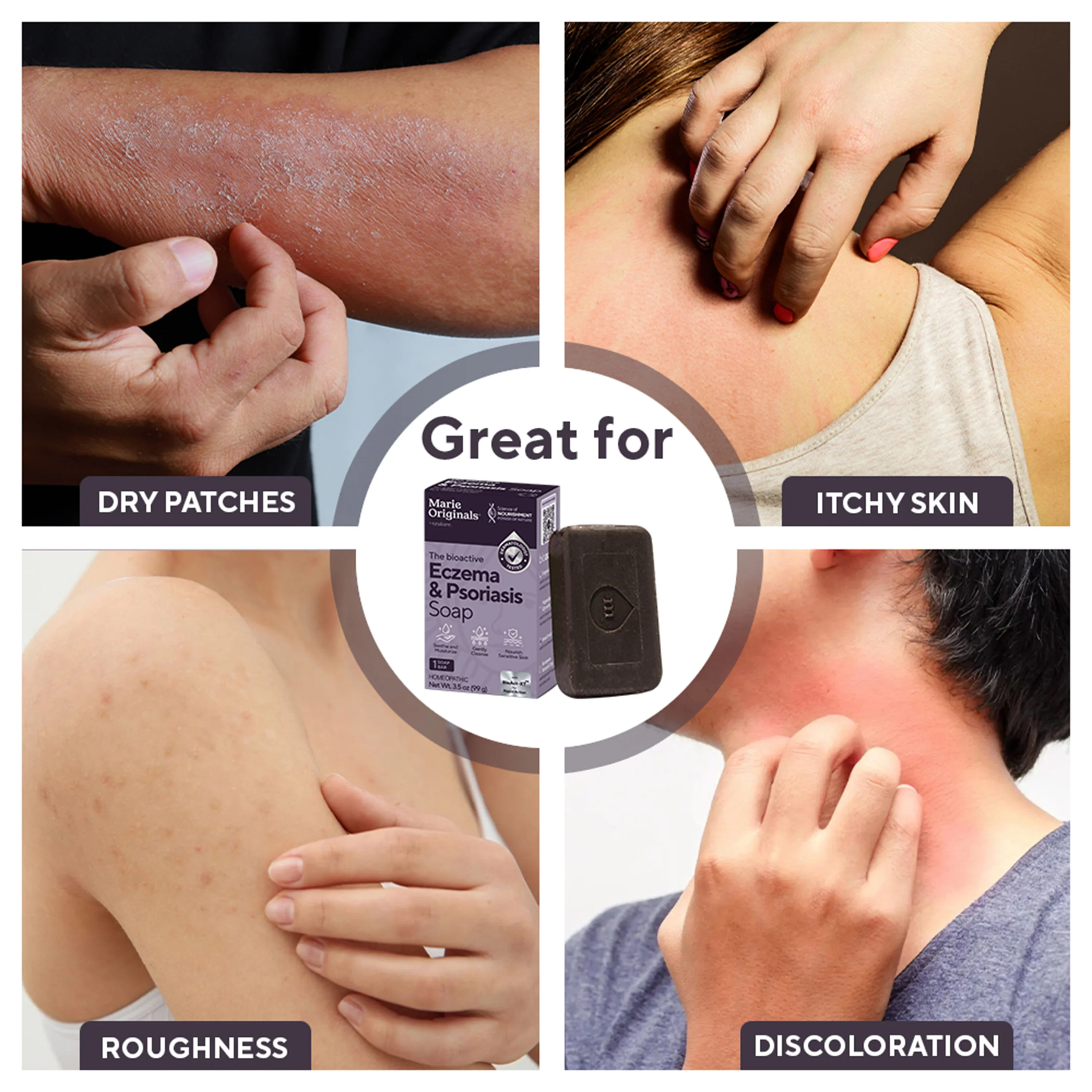 Eczema & Psoriasis Relief Soap - Image 5