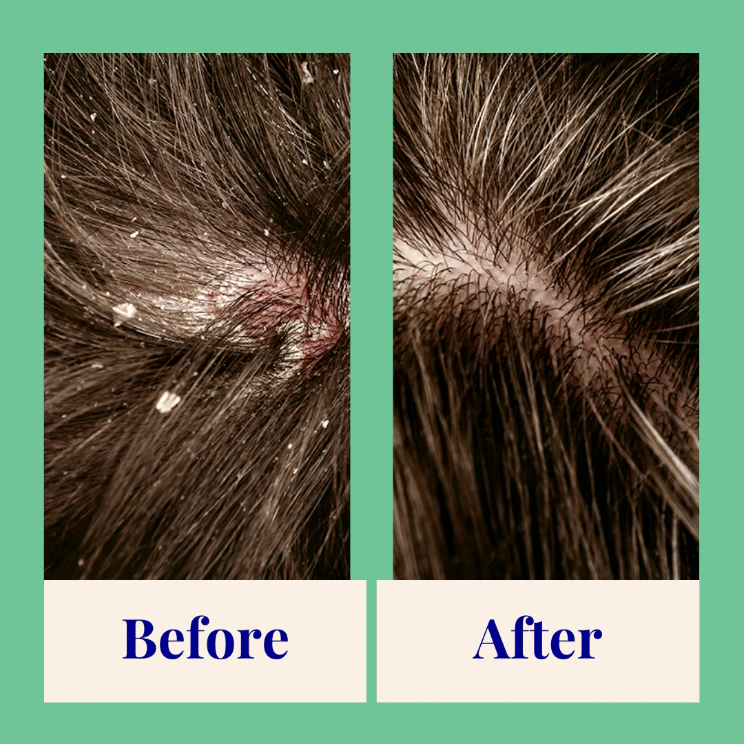 Exfoliating Shampoo - Image 4