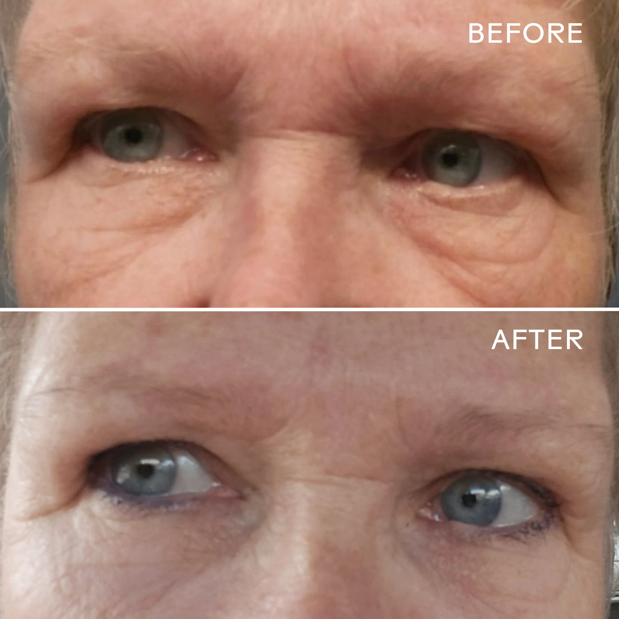 EyeHero™ Bio-Retinol Smoothing Eye Cream - Image 3