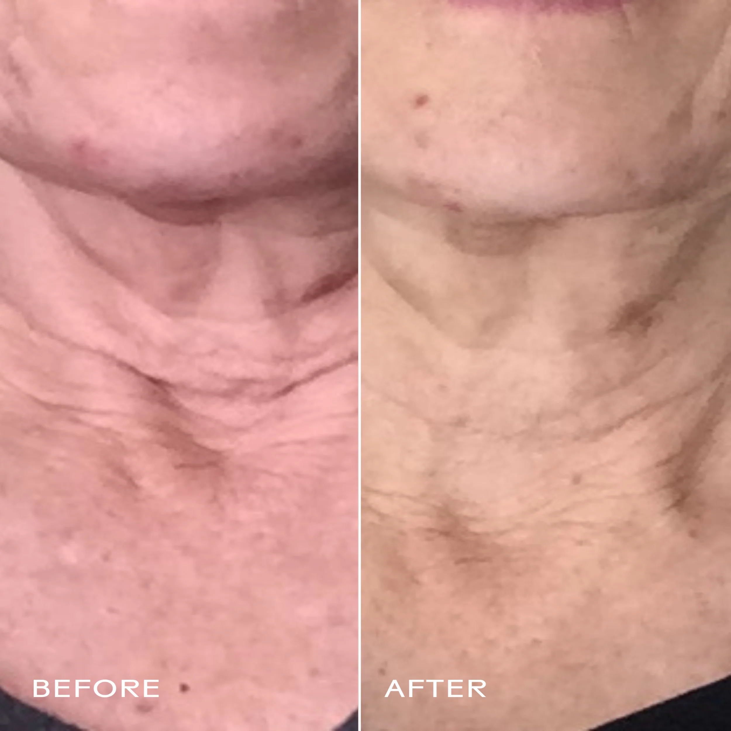 Firm Believer Goji Stem Cell + Pomegranate Smoothing Neck + Face Cream - Image 2