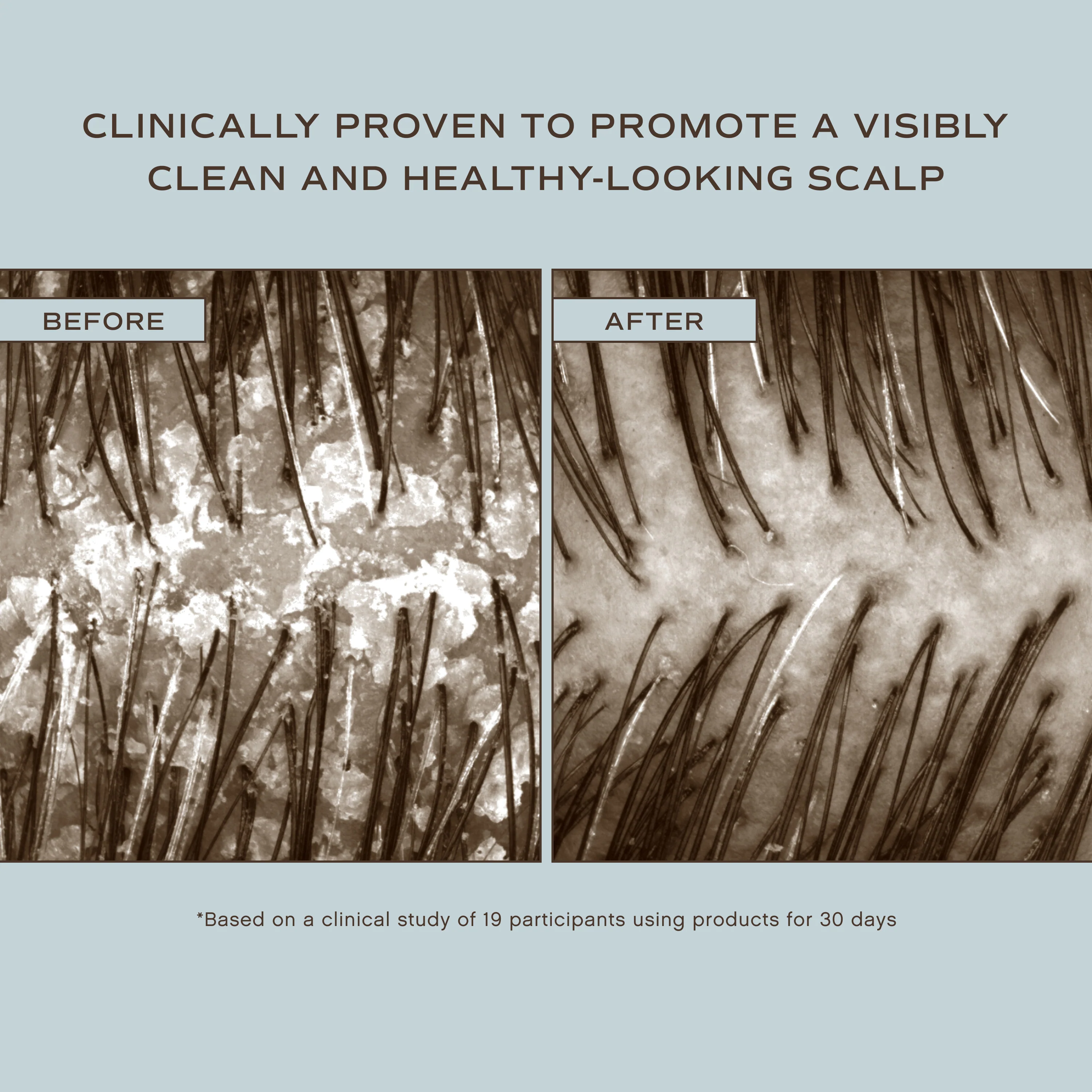 Hair Renew Scalp Conditioner - Image 4