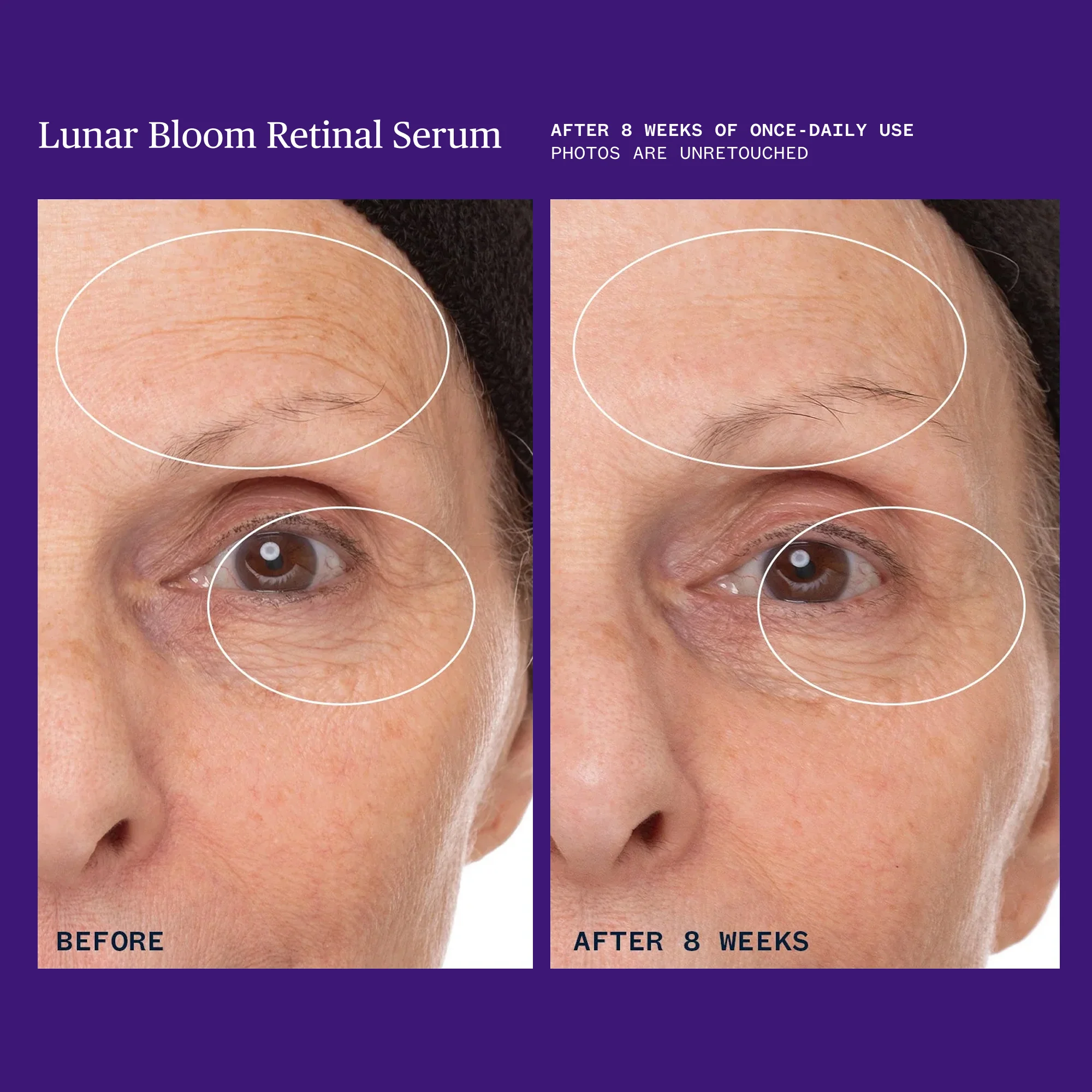 Lunar Bloom Retinal Serum - Image 8