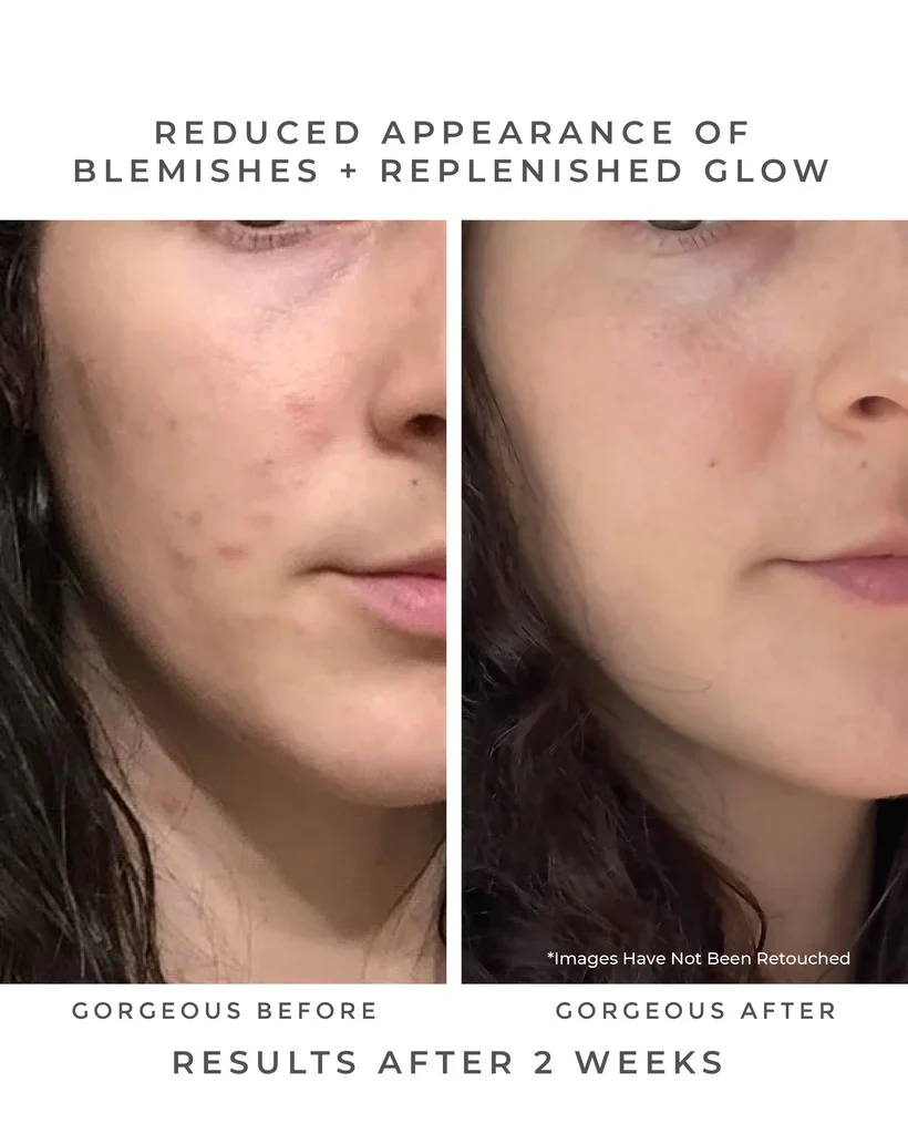 OASIS Deep Pore Gel Cleanser - Image 8