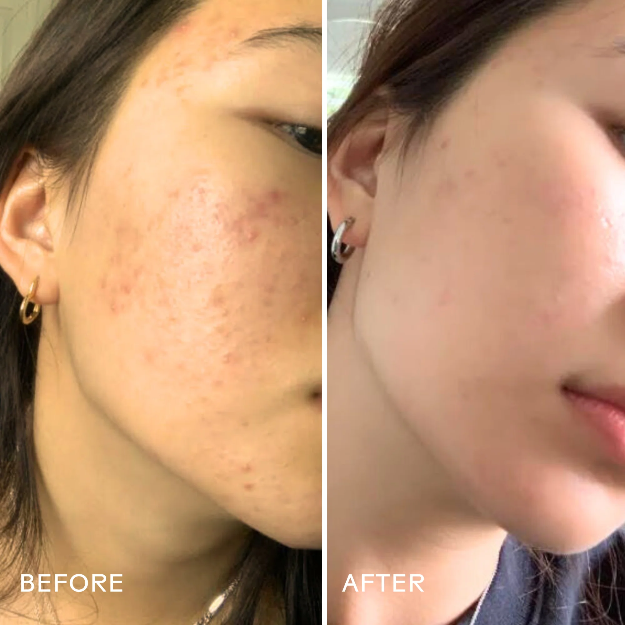 Purify Aloe + Amino Acid Gel Cleanser - Image 2