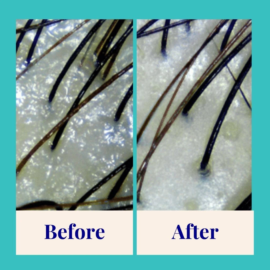 Purifying Shampoo - Image 3