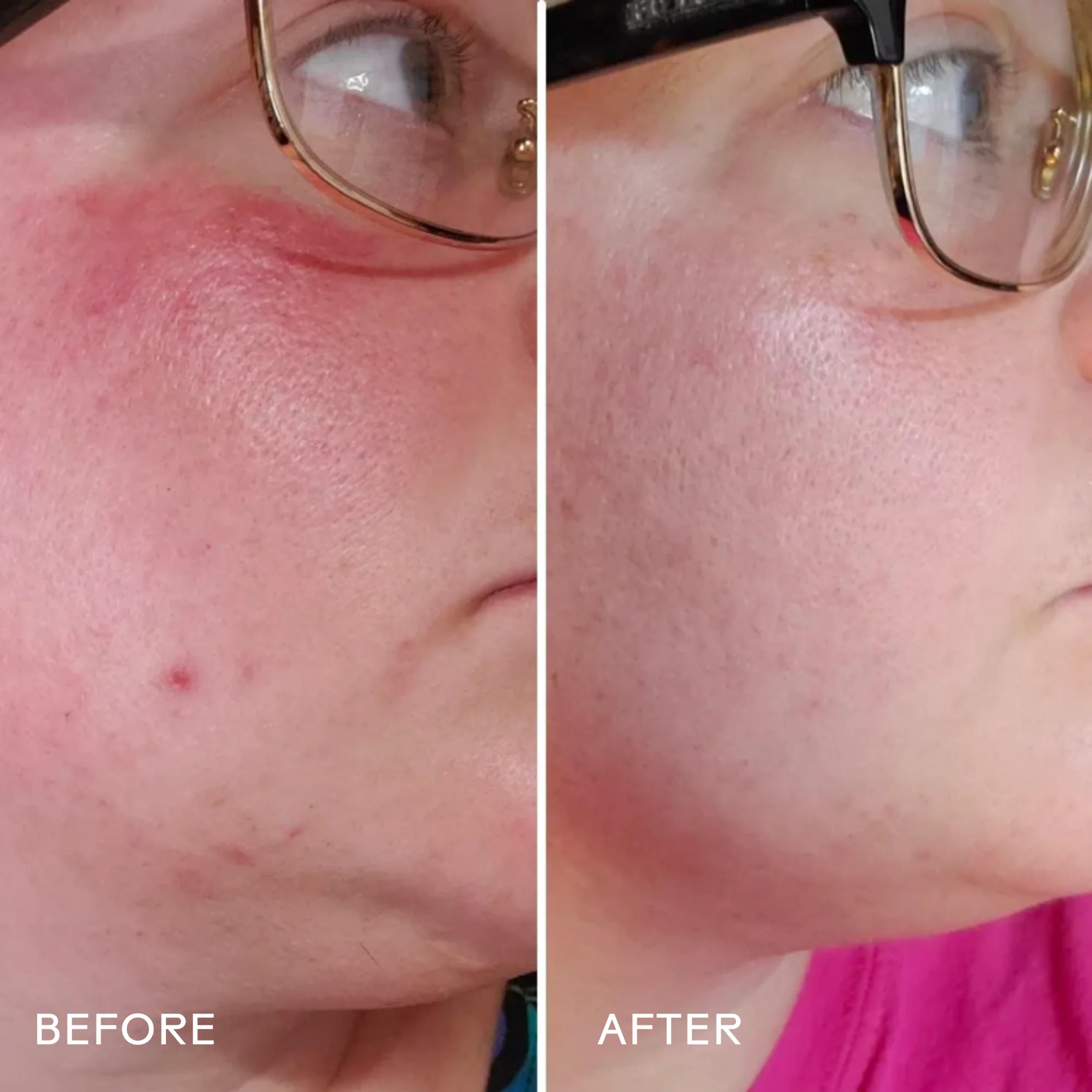 Radiance Grape Stem Cell + Squalane Ultra-Hydrating Cream - Image 2