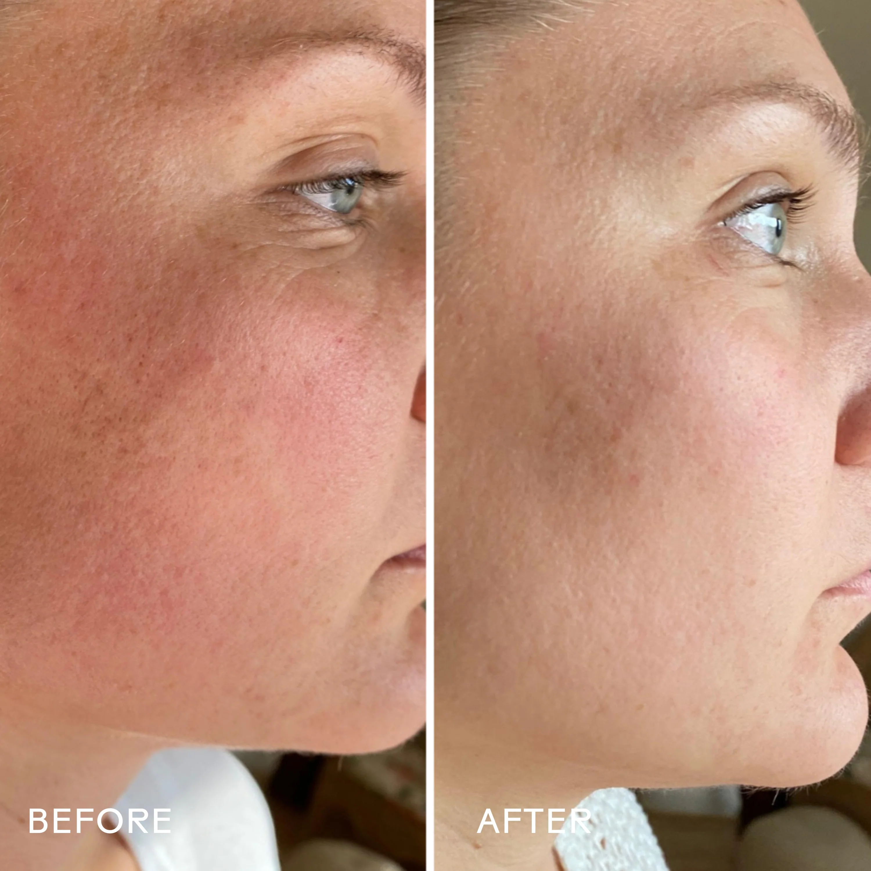 SkinHero™ Calendula + 2% Bakuchiol Bio-Retinol Serum - Image 2