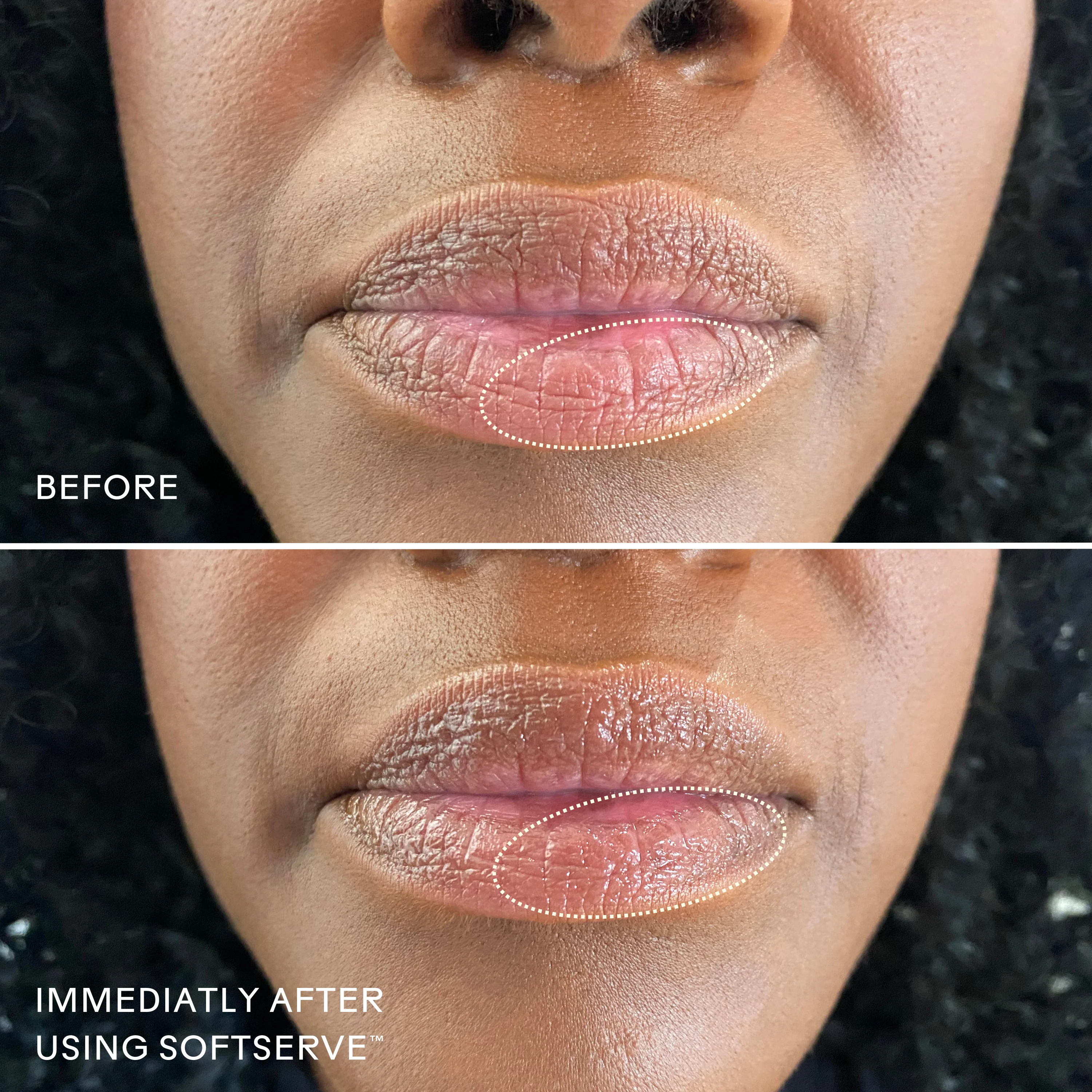 SoftServeâ„¢ Barrier-Building Lip Treatment - Image 8
