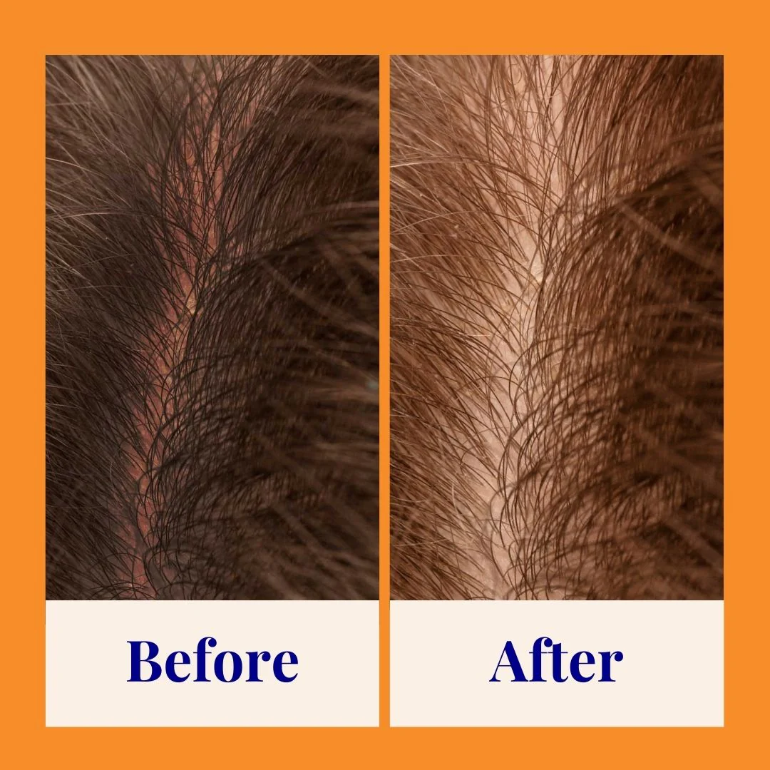 Strengthening & Soothing Powder Shampoo - Image 7